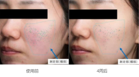 抗衰老案例